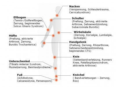 Schematische Körpersilhouette mit markierten Behandlungspunkten an Nacken, Schulter, Ellbogen, Wirbelsäule, Hüfte, Handgelenk, Knie, Unterschenkel, Knöchel und Fuß